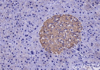 IRS-2 Rabbit Polyclonal Antibody