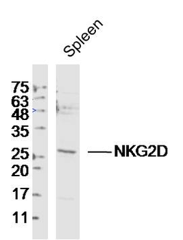 NKG2D Rabbit Polyclonal Antibody