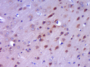 AR/Androgen receptor Rabbit Polyclonal Antibody