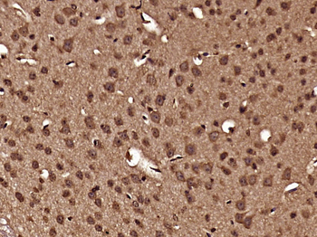 Tubulin, Alpha 4a Rabbit Polyclonal Antibody