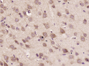 StAR Rabbit Polyclonal Antibody