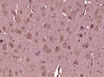 TMEM85 Rabbit Polyclonal Antibody