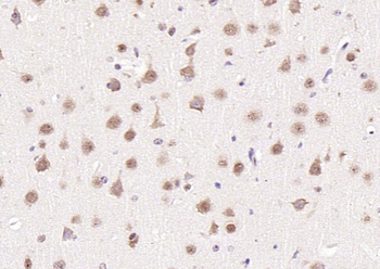 HRG1 Rabbit Polyclonal Antibody