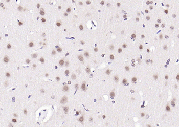 HRG1 Rabbit Polyclonal Antibody