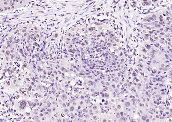 SOX9 Rabbit Polyclonal Antibody