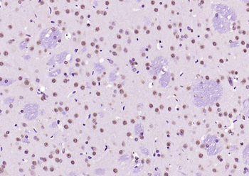 SOX9 Rabbit Polyclonal Antibody