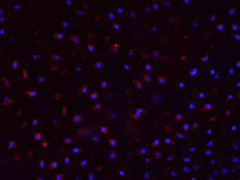 CYP11B1 Rabbit Polyclonal Antibody