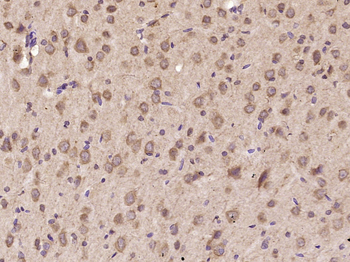 IL-11 Rabbit Polyclonal Antibody