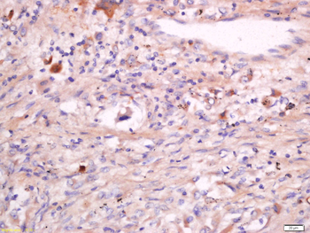 CD63 Rabbit Polyclonal Antibody