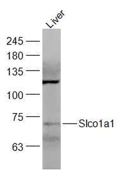 Slco1a1 Rabbit Polyclonal Antibody