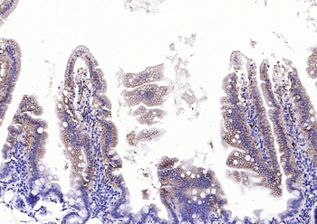 EMP-1 Rabbit Polyclonal Antibody