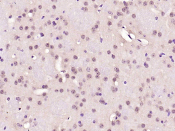 SOX2 Rabbit Polyclonal Antibody