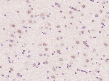 SOX2 Rabbit Polyclonal Antibody