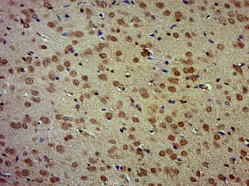 SOX2 Rabbit Polyclonal Antibody