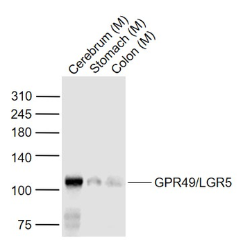 GPR49/LGR5 Rabbit Polyclonal Antibody