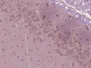 FAK Rabbit Polyclonal Antibody