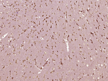 Nucleophosmin Rabbit Polyclonal Antibody