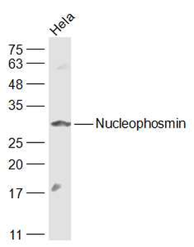 Nucleophosmin Rabbit Polyclonal Antibody