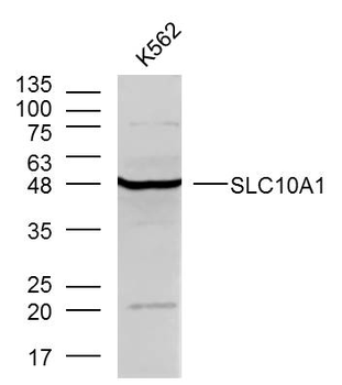 SLC10A1 Rabbit Polyclonal Antibody