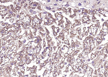 TGF beta Receptor II Rabbit Polyclonal Antibody