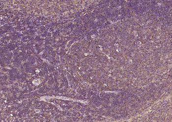 TGF beta Receptor II Rabbit Polyclonal Antibody