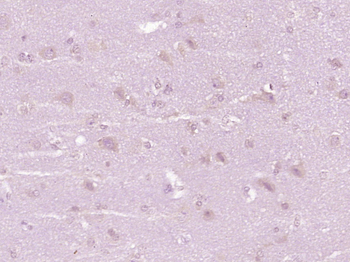 Vimentin Rabbit Polyclonal Antibody
