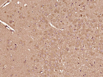 IRS-2 Rabbit Polyclonal Antibody