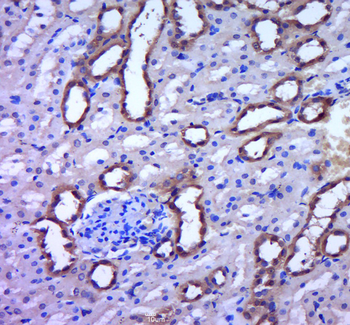 IRS-2 Rabbit Polyclonal Antibody