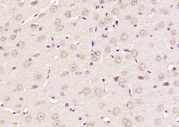 CK5+CK6 Rabbit Polyclonal Antibody