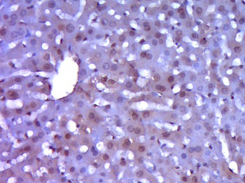 CK5+CK6 Rabbit Polyclonal Antibody