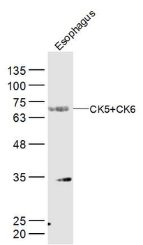CK5+CK6 Rabbit Polyclonal Antibody