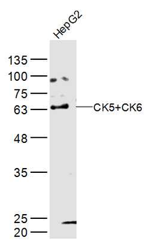 CK5+CK6 Rabbit Polyclonal Antibody