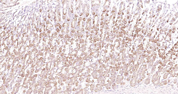 LRCH1 Rabbit Polyclonal Antibody