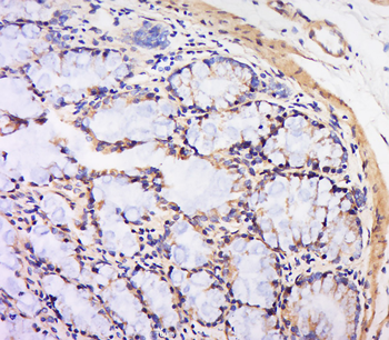 Gremlin Rabbit Polyclonal Antibody