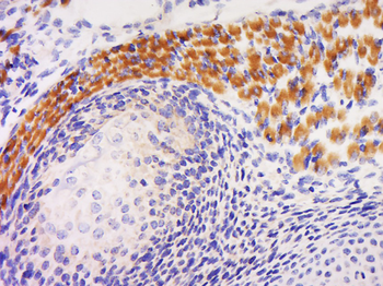 Gremlin Rabbit Polyclonal Antibody