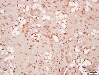 Beclin 1 Rabbit Polyclonal Antibody