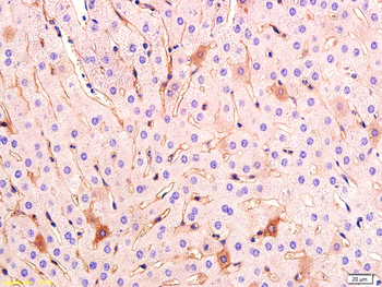 VEGFA Rabbit Polyclonal Antibody