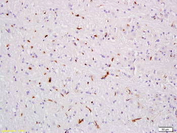 VEGFA Rabbit Polyclonal Antibody