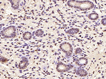 Cyclin D1 Rabbit Polyclonal Antibody