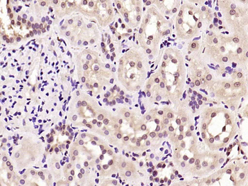Cyclin D1 Rabbit Polyclonal Antibody