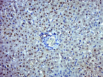 Cyclin D1 Rabbit Polyclonal Antibody