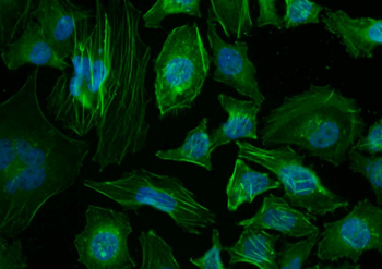 Beta-Actin Rabbit Polyclonal Antibody (Loading Control)