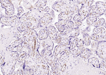 CD34 Rabbit Polyclonal Antibody