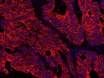 Cytokeratin 8 Mouse Monoclonal Antibody