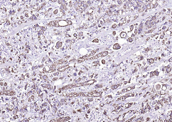 Cytokeratin 8 Mouse Monoclonal Antibody