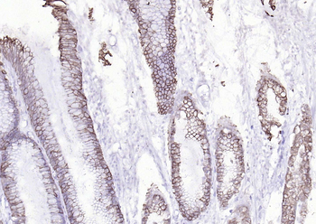 Cytokeratin 8 Mouse Monoclonal Antibody