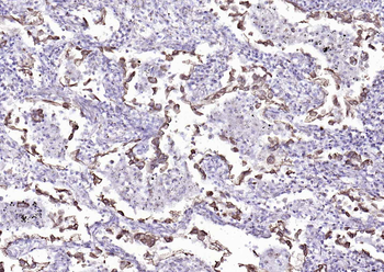 Cytokeratin 8 Mouse Monoclonal Antibody