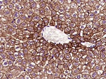 Cytokeratin 8 Mouse Monoclonal Antibody