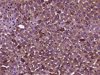 Cytokeratin 8 Mouse Monoclonal Antibody
