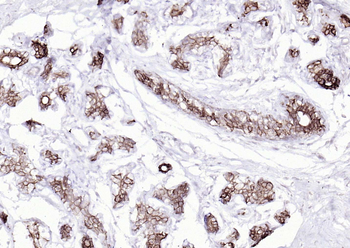 Cytokeratin 8 Mouse Monoclonal Antibody